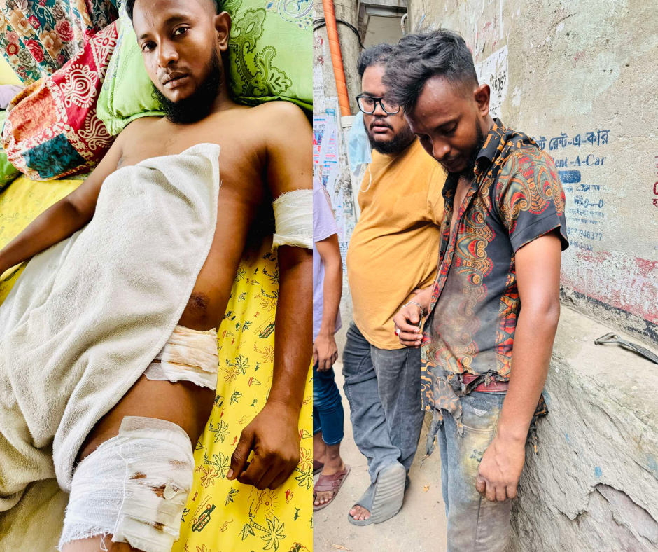 মালিবাগে বিএনপি -জামায়াতের বোমা হামলায় আহত স্বেচ্ছাসেবক লীগ নেতা